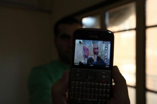 A Syrian activist and the phone pics of his torture